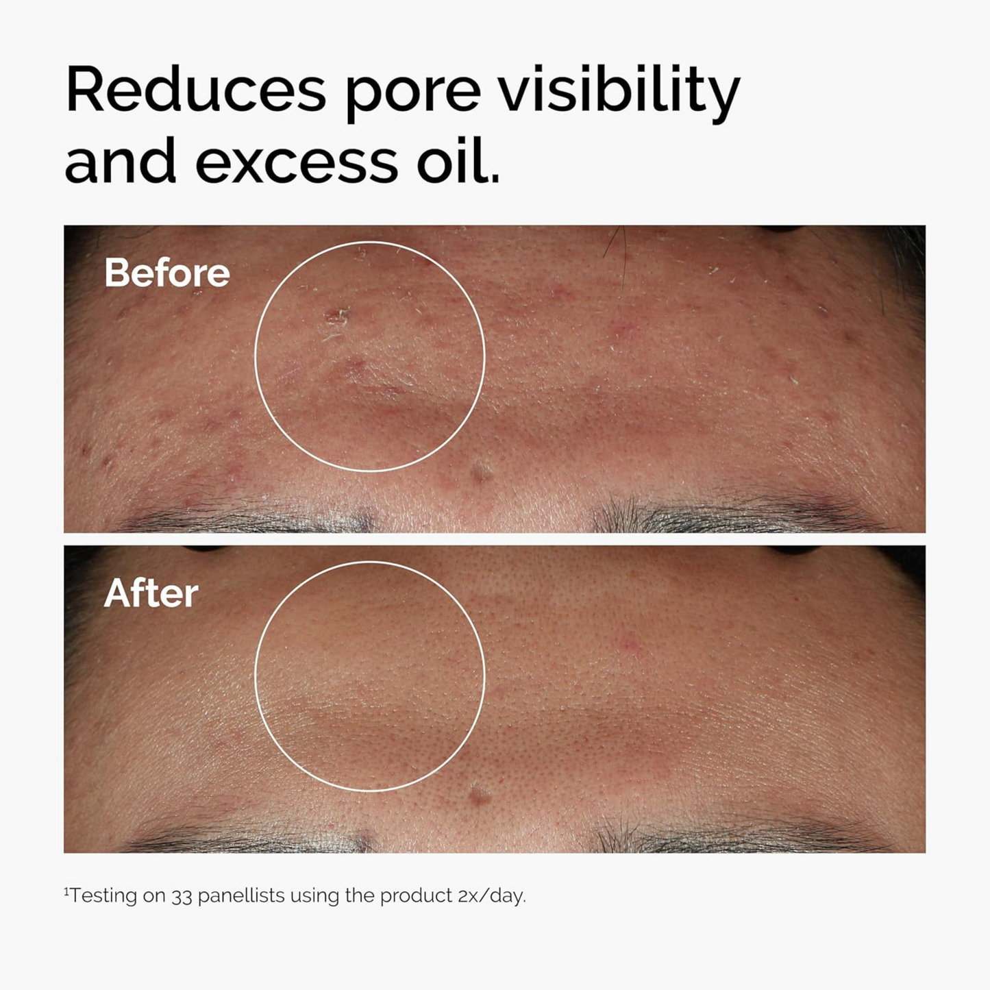 The Ordinary salicylic acid 2% solution 30 ml