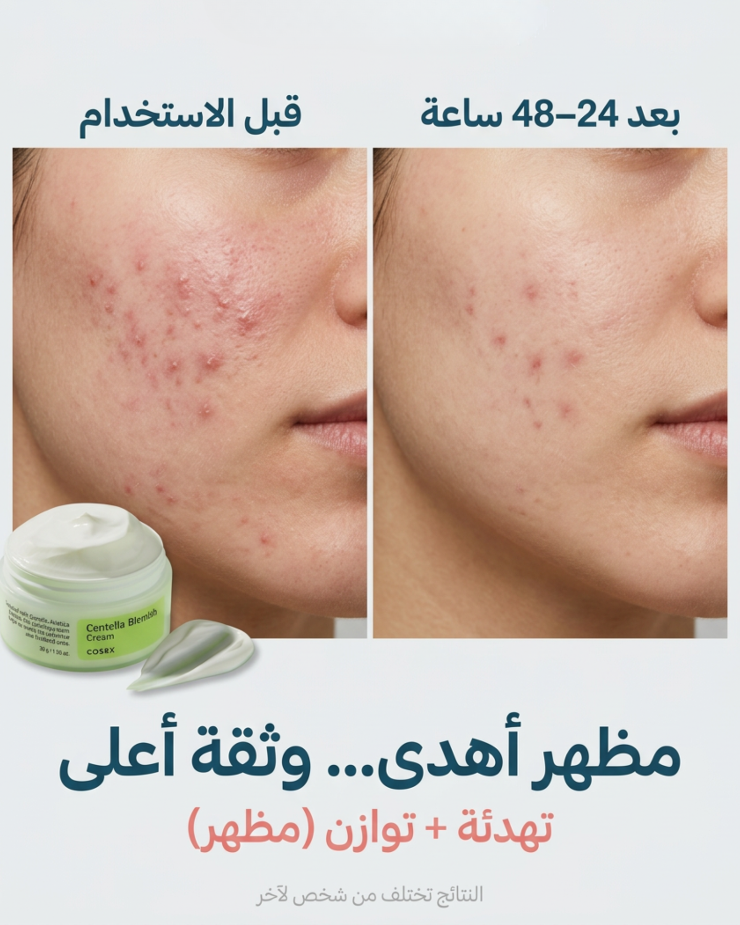 كوزركس كريم السنتيلا للعيوب والندبات 30 جم