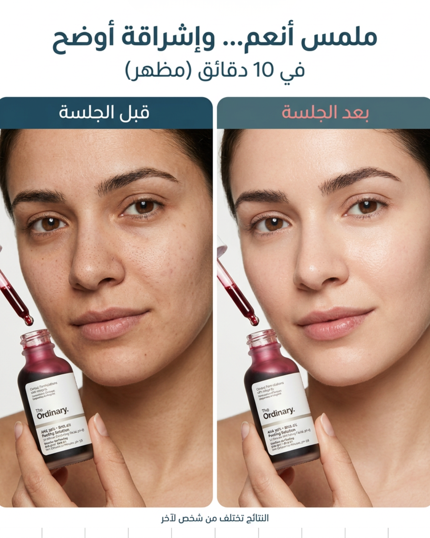 The Ordinary AHA 30% + BHA 2% peeling solution 30 ml